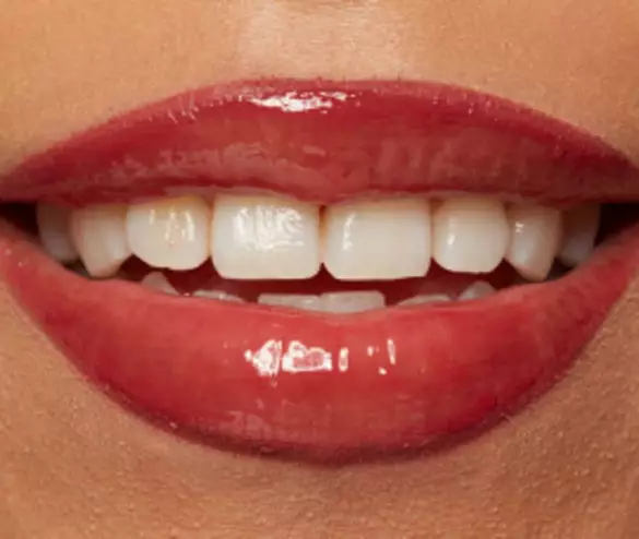 Close-up of a smiling mouth with glossy red lips and bright white teeth.