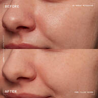 Pore Filler